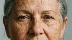 5 real reasons for the appearance of age spots that you should know (selection)